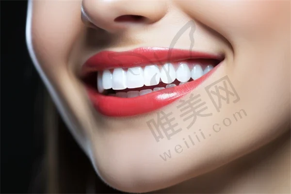 深圳洗牙收费情况