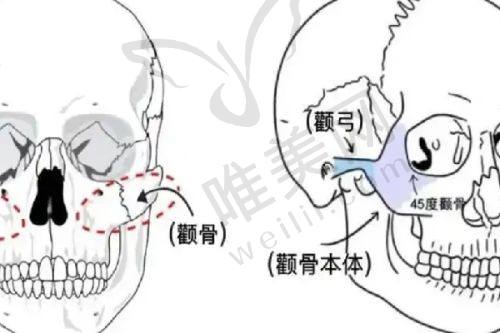 推荐医生：邓刚博士操刀男性假体三件套手术