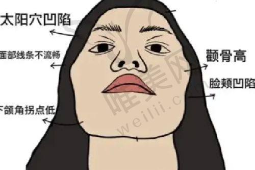上海玫瑰医疗美容医院 - 上海缩胸手术专精医院