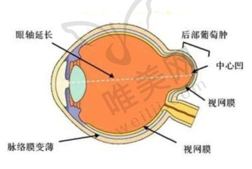 乌鲁木齐空军 医院近视眼手术情况