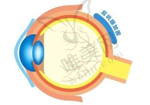 2025年西安四院眼科近视手术价格表明细