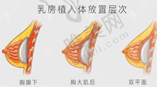 总结：选择沈阳友谊整形刘金超医生，美丽可期