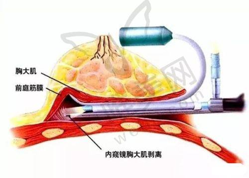 坐诊医院：沈阳友谊整形正规专精，舒适便捷
