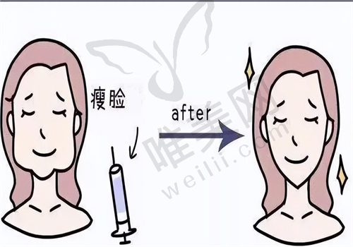 北京筋膜提升术后护理要点
