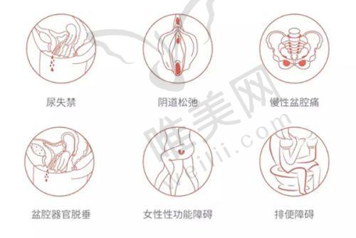 北京法令纹医院真人实录