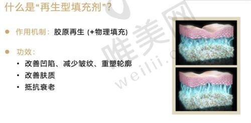湖州林华整形避坑指南