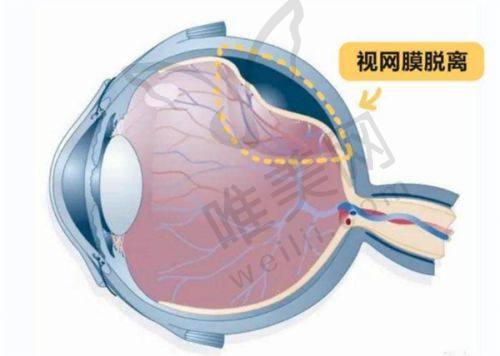 苏州太学眼科近视手术亮点解读