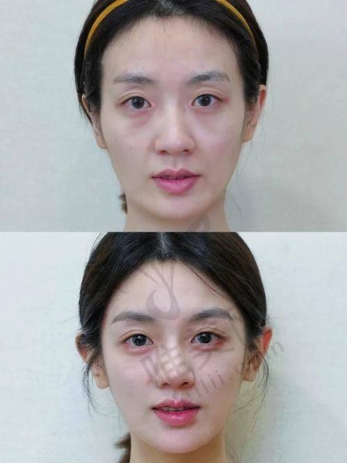 黄剑美和谢雯技术流派大拆解