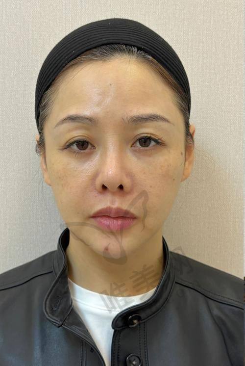 选择黄剑美和谢雯的决策树
