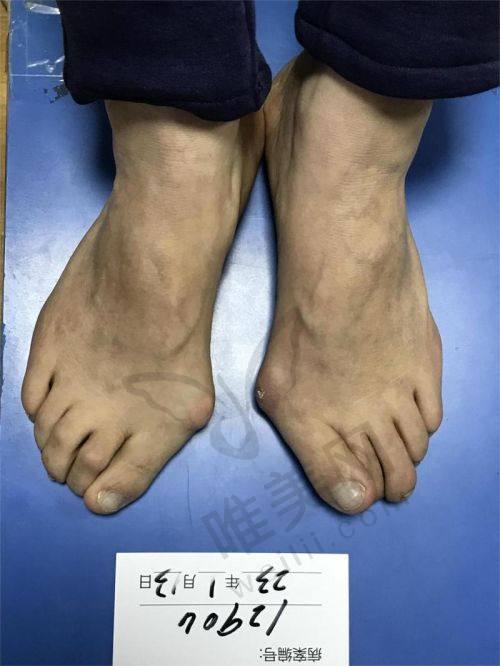 陈圣英和苏敬达医生选择建议