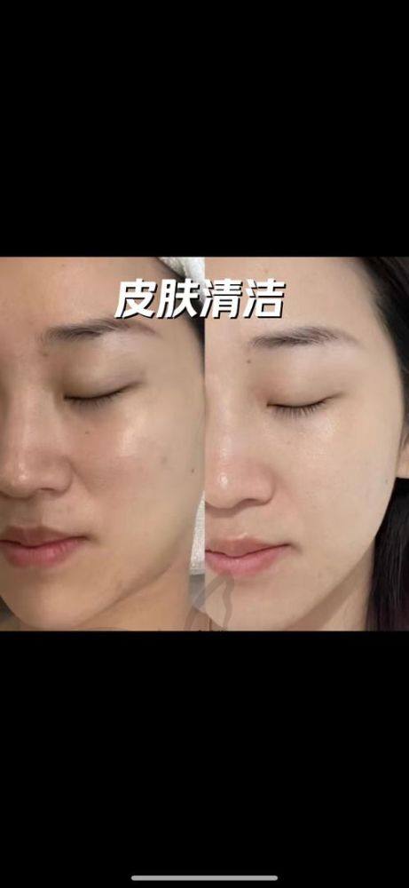 总结：深圳市光明区人民医院皮肤科——值得专程打卡的优质科室