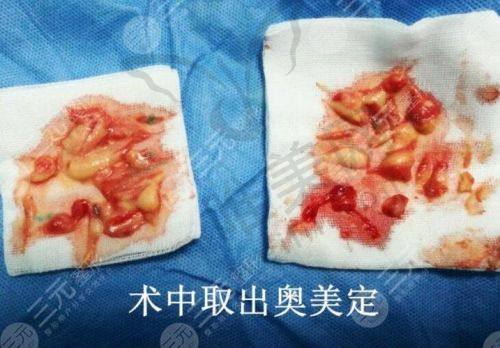 结语