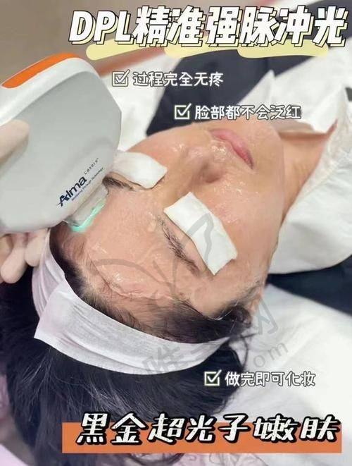 选对宁波光子嫩肤医院关键要点