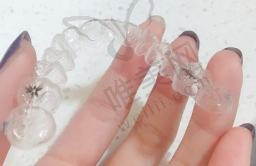 儋州匠心口腔门诊部正规吗？医院口碑反馈