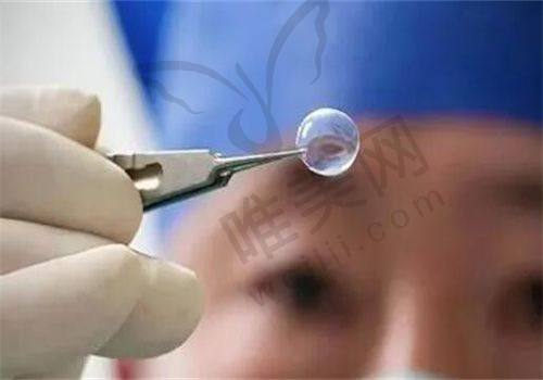 2025年爱尔眼科斜弱视手术价格表
