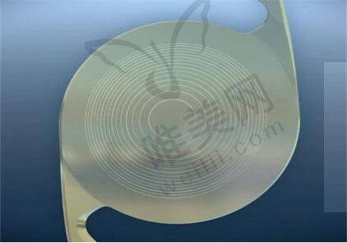 潍坊明润眼科医院2025新版近视手术价格全公开