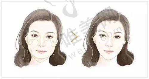 2025龙华人民医院整形科预约挂号指南