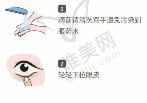 2025年爱尔眼科老视手术价格表