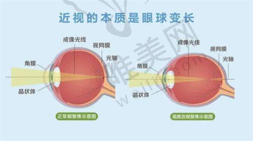 2025年爱尔眼科医院优势总结