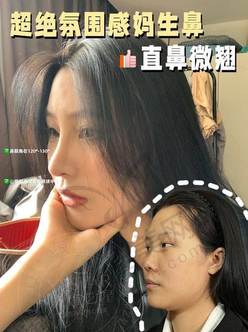 深圳注射隆鼻医院排名情况
