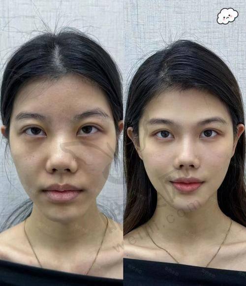 武汉吴勇波顾客好评如潮