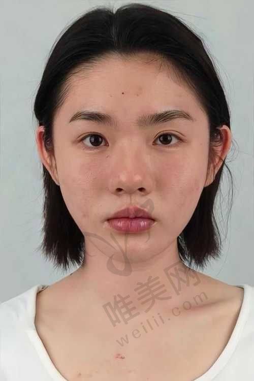 昆明热玛吉总体推荐