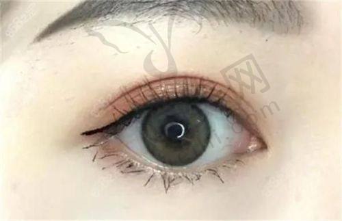 总结