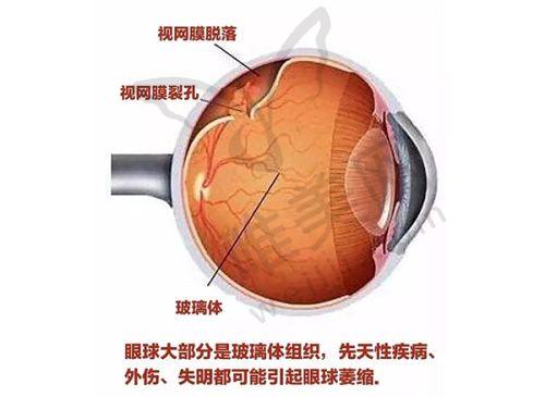 贵州省人民医院近视手术预约方式