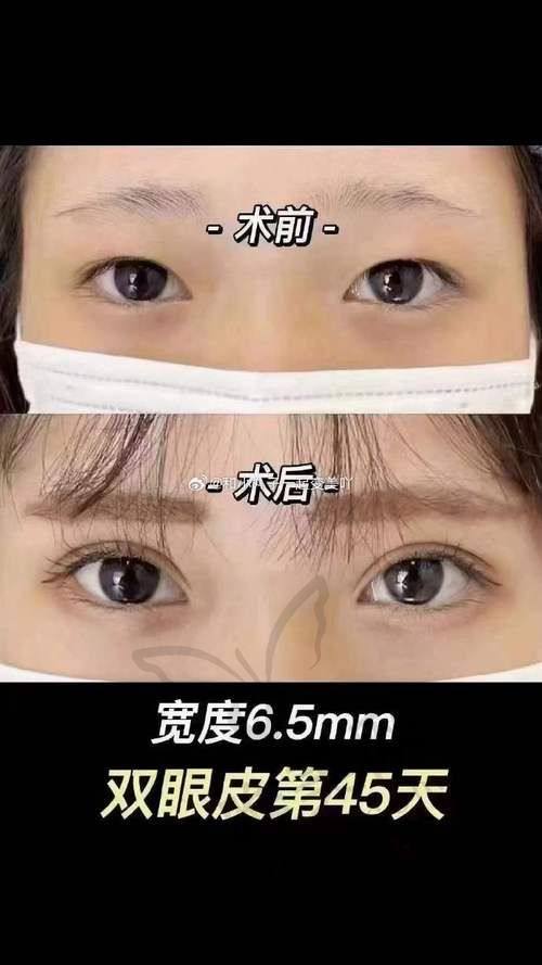金华正规医美机构前十名资料大起底
