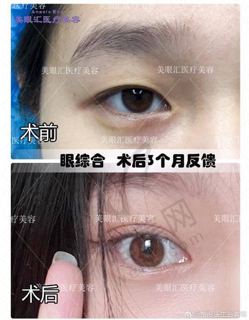 金华双眼皮正规医院排名前十名单
