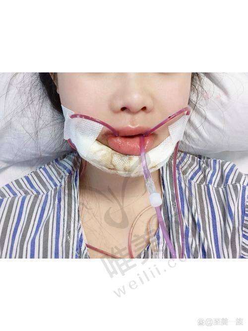 重庆肖林正颌档次揭秘