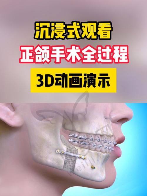 异地正畸服务
