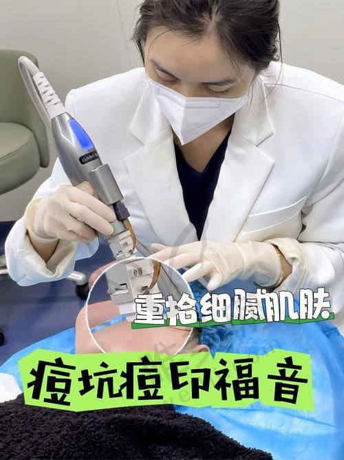 影响珠海黄金微针第五代价格的4大关键因素