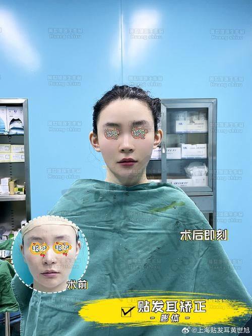 长沙精灵耳整形选医生选机构方法