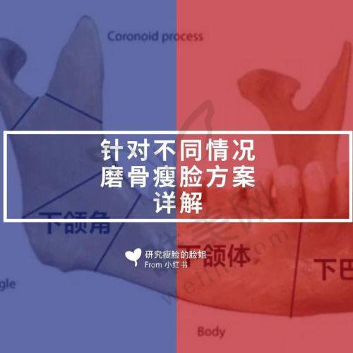 深圳罗奇磨骨有无失败实例和黑料
