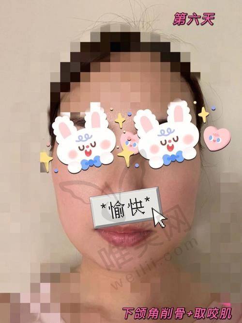深圳罗奇磨骨的资质情况