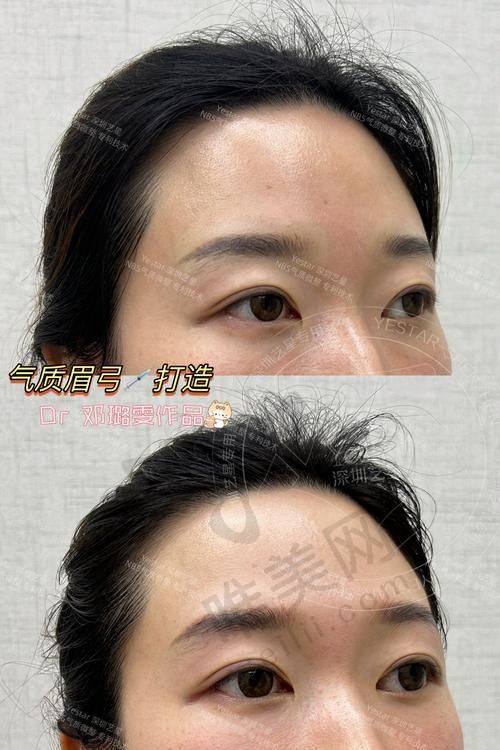 西安眉弓做得比较好的医美机构实地测评