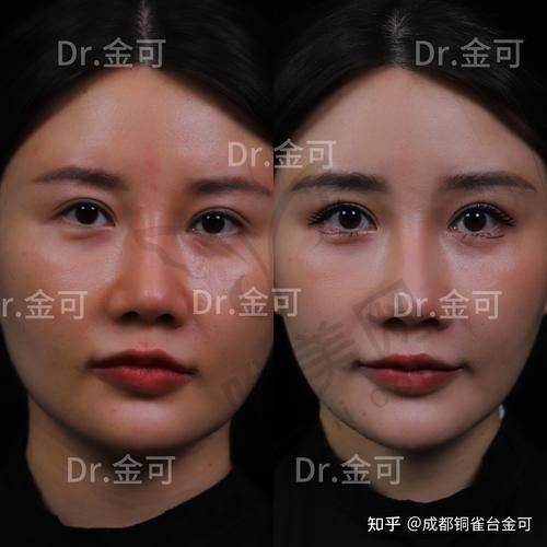 术后护理重点