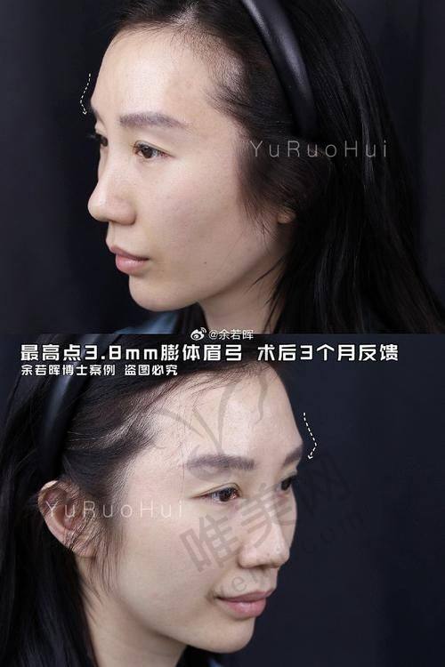 避坑指南