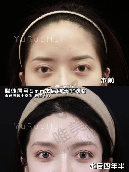 总结
