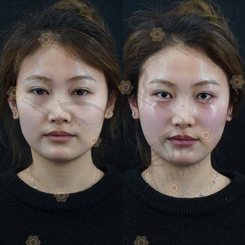 价格对比：结合预算，理性选择黄罡、王阔远、李方奇馒化脸修复医生