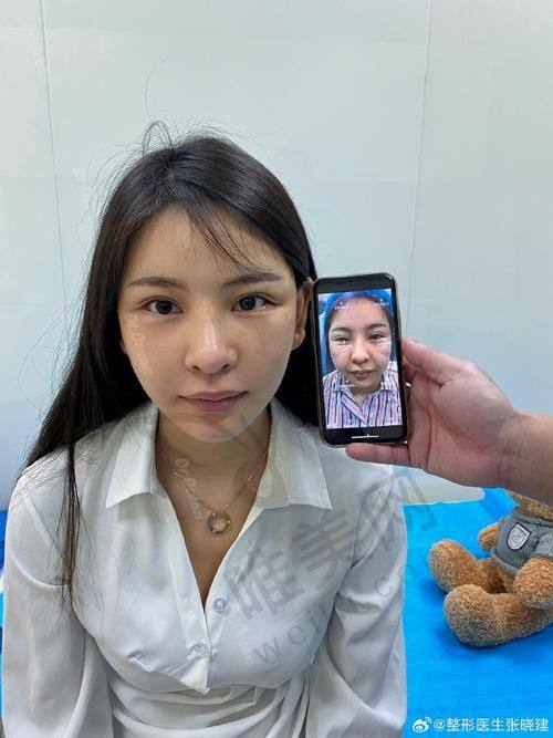 审美风格对比：黄罡、王阔远、李方奇不同风格，满足多样馒化脸修复需求