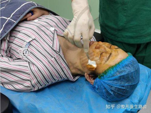 深圳阳光医院筋膜提升价格详情明晰
