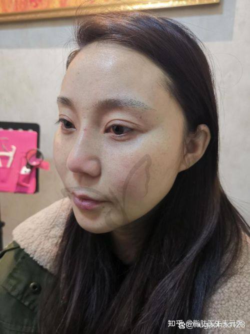 二、爱贝芙官网授权医院的重要性