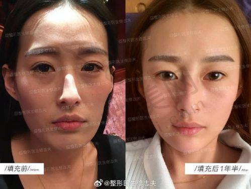 五、抓住机会，选择爱贝芙官网授权医院变得更美
