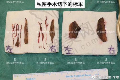 一、北京紧缩医院做的较好的医院之私密紧缩项目