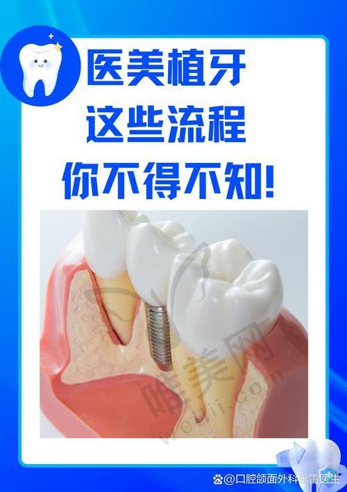 二、安康其他种植牙医院特色