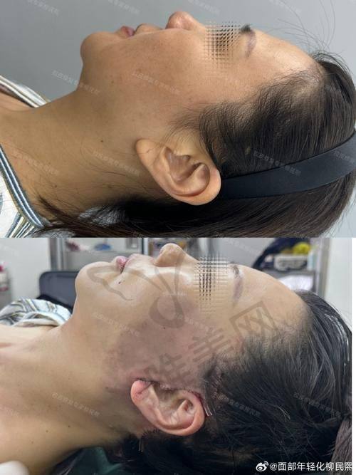 五、北京小拉皮优质医院推荐——北京联合丽格医疗美容