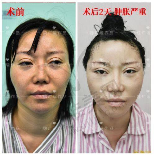 二、北京小拉皮优质医院推荐——北京华韩医疗美容医院