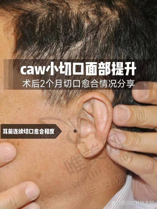 四、北京小拉皮优质医院推荐——北京加减美医疗美容